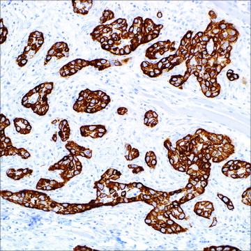 Cytokeratin 5 (EP1601Y) + Cytokeratin 14 (LL002) Mouse and Rabbit Monoclonal Antibody