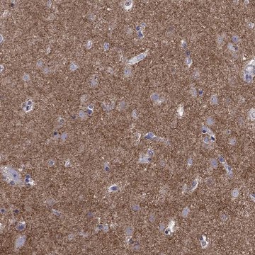 Anti-GNAL antibody produced in rabbit Prestige Antibodies&#174; Powered by Atlas Antibodies, affinity isolated antibody