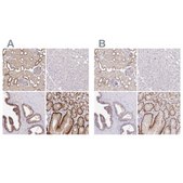 Anti-SLC9A1 antibody produced in rabbit Prestige Antibodies&#174; Powered by Atlas Antibodies, affinity isolated antibody, buffered aqueous glycerol solution