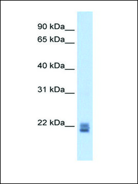 Anti-RGS1 antibody produced in rabbit IgG fraction of antiserum
