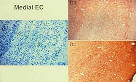 Anti-Dopamine D2 Receptor Antibody Chemicon&#174;, from rabbit