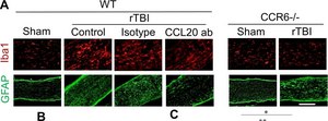Anti-Glial Fibrillary Acidic Protein Antibody Chemicon&#174;, from chicken