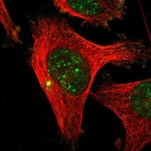 Anti-CENPU antibody produced in rabbit Prestige Antibodies&#174; Powered by Atlas Antibodies, affinity isolated antibody, buffered aqueous glycerol solution
