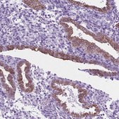 Anti-HTR2B antibody produced in rabbit Prestige Antibodies&#174; Powered by Atlas Antibodies, affinity isolated antibody, buffered aqueous glycerol solution