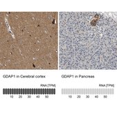Anti-GDAP1 antibody produced in rabbit Prestige Antibodies&#174; Powered by Atlas Antibodies, affinity isolated antibody, buffered aqueous glycerol solution