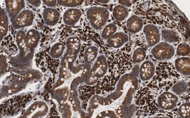 Anti-Derlin-1 Antibody, clone 2C2, ZooMAb&#174; Rabbit Monoclonal recombinant, expressed in HEK 293 cells