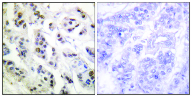 Anti-Lamin A antibody produced in rabbit affinity isolated antibody