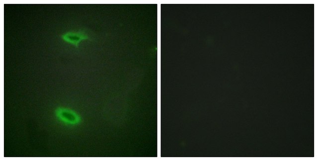 Anti-DLGP1 antibody produced in rabbit affinity isolated antibody
