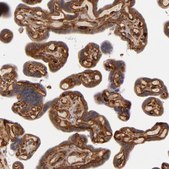Anti-LAMC1 antibody produced in rabbit Ab1, Prestige Antibodies&#174; Powered by Atlas Antibodies, affinity isolated antibody, buffered aqueous glycerol solution