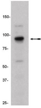 Anti-SUZ12 Antibody, clone 3C1.2 clone 3C1.2, Upstate&#174;, from mouse