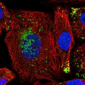 Anti-HILPDA antibody produced in rabbit Prestige Antibodies&#174; Powered by Atlas Antibodies, affinity isolated antibody, buffered aqueous glycerol solution