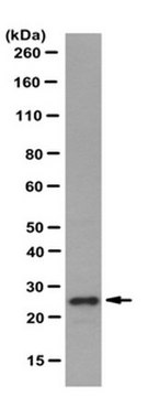 Anti-Sigma IR Antibody, clone ICR-SIG1R-A clone ICR-SIG1R-A, from rat