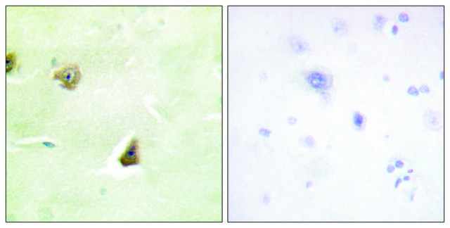 Anti-DUSP6 antibody produced in rabbit affinity isolated antibody