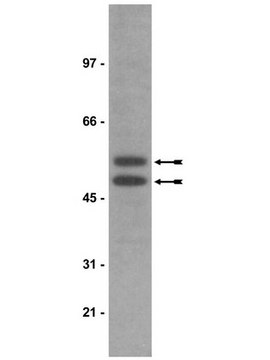 Anti-phospho-GSK3 (Tyr279/Tyr216) Antibody, clone 5G-2F clone 5G-2F, Upstate&#174;, from mouse