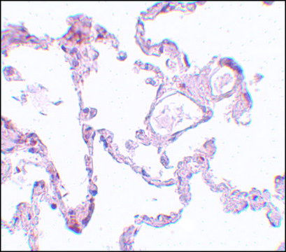 Anti-PLEKHM1 antibody produced in rabbit affinity isolated antibody, buffered aqueous solution