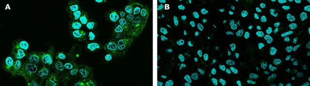 BioTracker&#8482; Spermine Polyamine Green Fluorescent Live Cell Probe