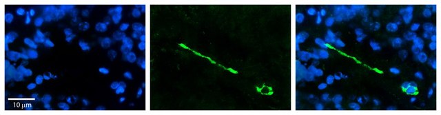 Anti-MTUS1 antibody produced in rabbit affinity isolated antibody