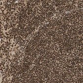 Anti-RNF113A antibody produced in rabbit Prestige Antibodies&#174; Powered by Atlas Antibodies, affinity isolated antibody, buffered aqueous glycerol solution