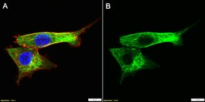 Anti-&#945; Tubulin Antibody, clone 2F2 ZooMAb&#174; Rabbit Monoclonal recombinant, expressed in HEK 293 cells