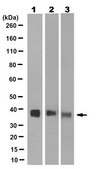 Anticorpo anti-sinaptofisina, clone SY38 clone SY38, from mouse