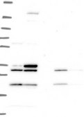 Anti-MEOX1 antibody produced in rabbit Prestige Antibodies&#174; Powered by Atlas Antibodies, affinity isolated antibody, buffered aqueous glycerol solution