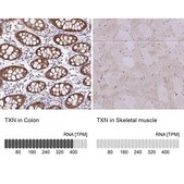 Anti-TXN antibody produced in rabbit Prestige Antibodies&#174; Powered by Atlas Antibodies, affinity isolated antibody, buffered aqueous glycerol solution