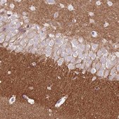 Anti-DPP6 antibody produced in rabbit Prestige Antibodies&#174; Powered by Atlas Antibodies, affinity isolated antibody, buffered aqueous glycerol solution
