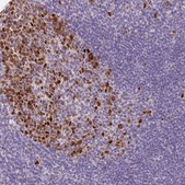 Anti-KPNA2 antibody produced in rabbit Prestige Antibodies&#174; Powered by Atlas Antibodies, affinity isolated antibody, buffered aqueous glycerol solution