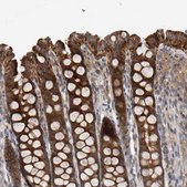 Anti-C9orf72 antibody produced in rabbit Prestige Antibodies&#174; Powered by Atlas Antibodies, affinity isolated antibody, buffered aqueous glycerol solution