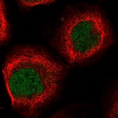Anti-EID2 antibody produced in rabbit Prestige Antibodies&#174; Powered by Atlas Antibodies, affinity isolated antibody, buffered aqueous glycerol solution
