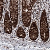 Anti-COA7 antibody produced in rabbit Prestige Antibodies&#174; Powered by Atlas Antibodies, affinity isolated antibody, buffered aqueous glycerol solution, ab2
