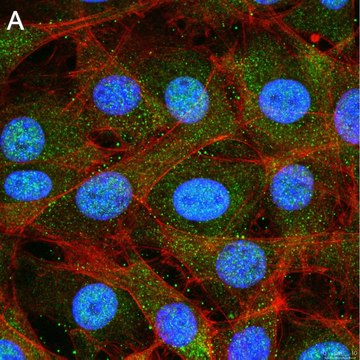 Anti-Treslin Antibody, clone 5L19 ZooMAb&#174; Rabbit Monoclonal recombinant, expressed in HEK 293 cells