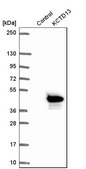 Anti-KCTD13 antibody produced in rabbit Prestige Antibodies&#174; Powered by Atlas Antibodies, affinity isolated antibody, buffered aqueous glycerol solution