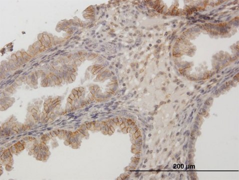 Anti-CD44 antibody produced in mouse purified immunoglobulin, buffered aqueous solution