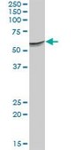 Anti-SERPINF2 antibody produced in mouse purified immunoglobulin, buffered aqueous solution