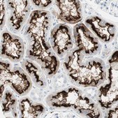 Anti-CDHR5 antibody produced in rabbit Prestige Antibodies&#174; Powered by Atlas Antibodies, affinity isolated antibody, buffered aqueous glycerol solution