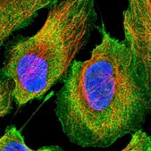 Anti-ETNK1 antibody produced in rabbit Prestige Antibodies&#174; Powered by Atlas Antibodies, affinity isolated antibody, buffered aqueous glycerol solution