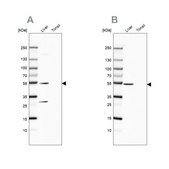 Anti-HGD antibody produced in rabbit Prestige Antibodies&#174; Powered by Atlas Antibodies, affinity isolated antibody, buffered aqueous glycerol solution