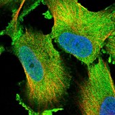 Anti-LTV1 antibody produced in rabbit Prestige Antibodies&#174; Powered by Atlas Antibodies, affinity isolated antibody, buffered aqueous glycerol solution, ab2