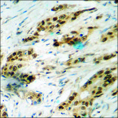 Anti-phospho-FKHR (pSer256) antibody produced in rabbit affinity isolated antibody