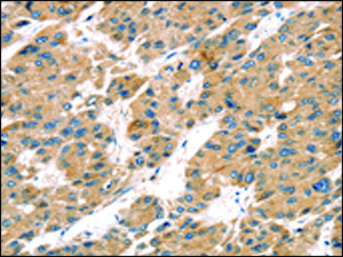 Anti-TRPV5 affinity isolated antibody