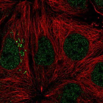 Anti-ST14 antibody produced in rabbit Prestige Antibodies&#174; Powered by Atlas Antibodies, affinity isolated antibody