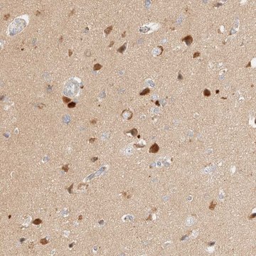 Anti-SGSM2 antibody produced in rabbit Prestige Antibodies&#174; Powered by Atlas Antibodies, affinity isolated antibody, buffered aqueous glycerol solution, Ab2