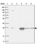 Anti-PSMA5 antibody produced in rabbit Prestige Antibodies&#174; Powered by Atlas Antibodies, affinity isolated antibody, buffered aqueous glycerol solution, ab3