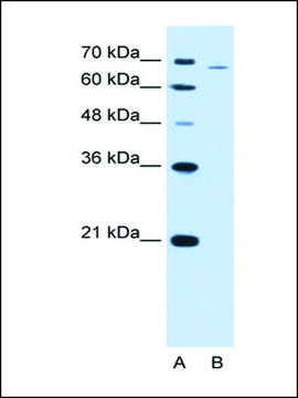 Anti-PFKL antibody produced in rabbit IgG fraction of antiserum