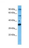 Anti-TBX5 (AB1) antibody produced in rabbit affinity isolated antibody