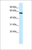 Anti-EYA1 antibody produced in rabbit affinity isolated antibody