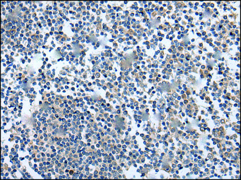 Anti-WNT5A affinity isolated antibody