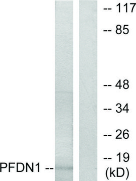 Anti-PFDN1 antibody produced in rabbit affinity isolated antibody