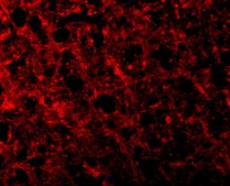 Anti-ATR antibody produced in rabbit purified antibody (Ion exchange)